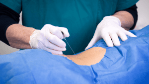 Infiltração na Coluna com Dr. Filipe Arruda