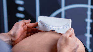 Cirurgia da Escoliose: O caminho para a correção da curvatura da coluna