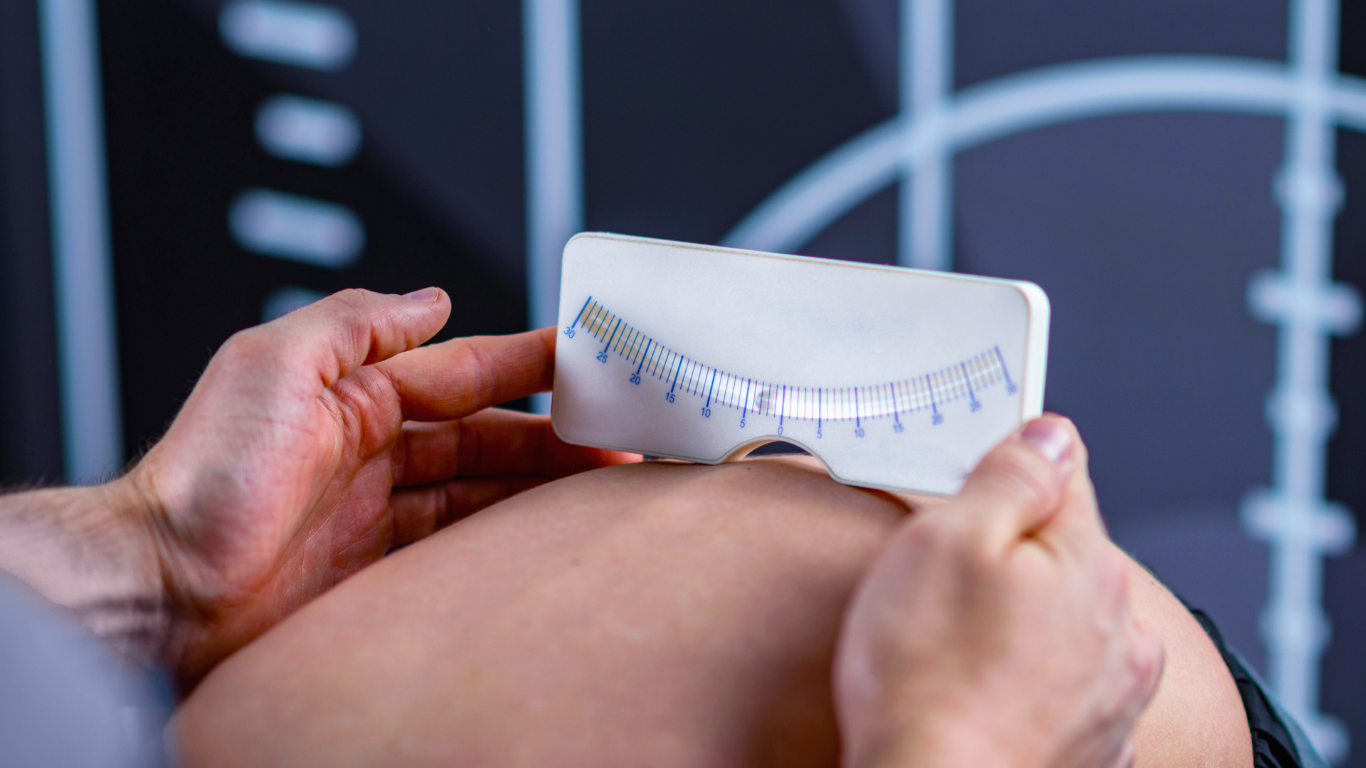 Cirurgia da Escoliose: O caminho para a correção da curvatura da coluna