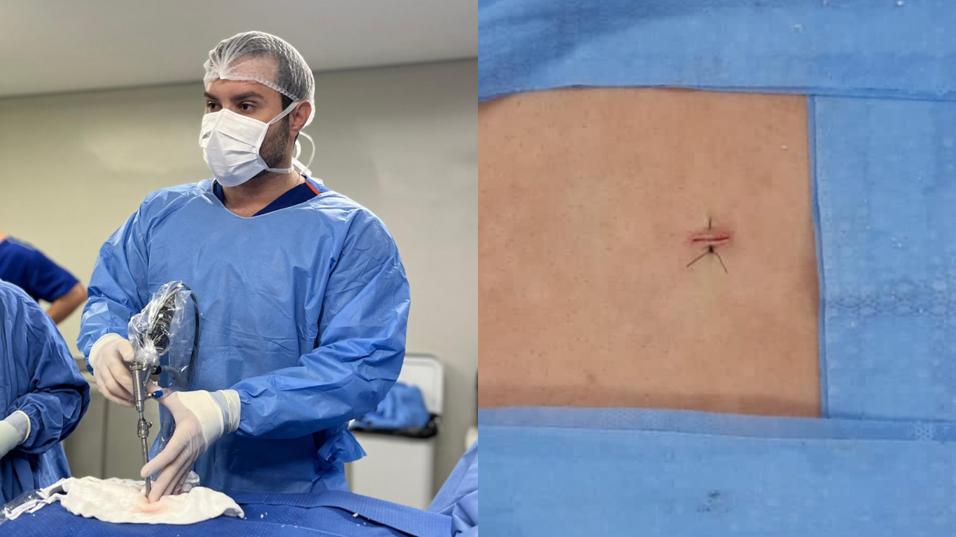 O que é a endoscopia de coluna com Dr. Filipe Arruda