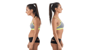 Cirurgia de Cifose: Corrigindo a Curvatura Excessiva da Coluna